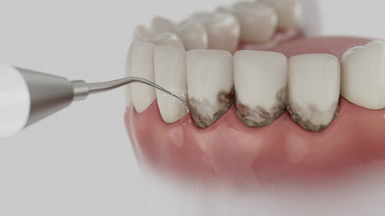 Reliable Emergency Dentist contractor in Spencer, IN by Smile Center Dentistry